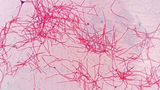 Figure 2. Fusobacterium necrophorum au microscope.